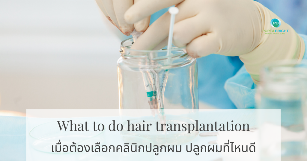 เตรียมปลูกผม